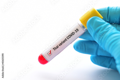 Thai variant of COVID-19, blood sample tube positive with Thai strain of COVID-19 virus 