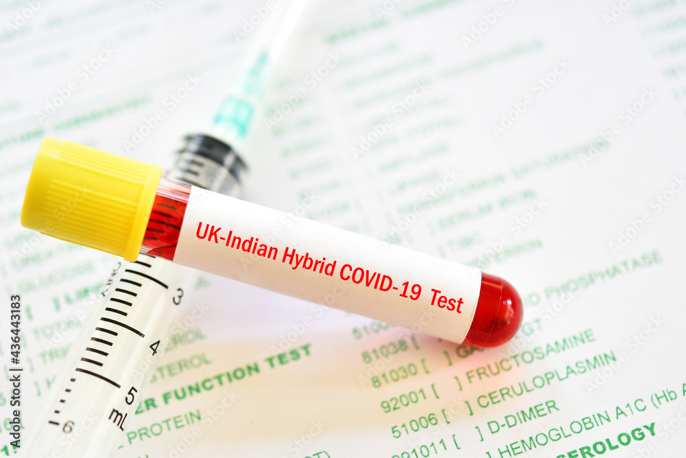UK-Indian hybrid COVID-19 test, blood sample tube for hybrid UK-Indian variant COVID-19 test