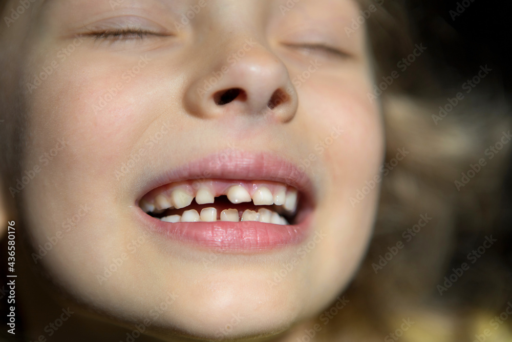 The child shows a loose tooth.The baby tooth is on the verge of falling out.The first molars.Teeth grow unevenly and require correction.The girl has a front tooth sticking out.Baby shows her teeth The child shows a loose tooth.The baby tooth is on the verge of falling out.The first molars.Teeth grow unevenly and require correction.The girl has a front tooth sticking out.Baby shows her teeth