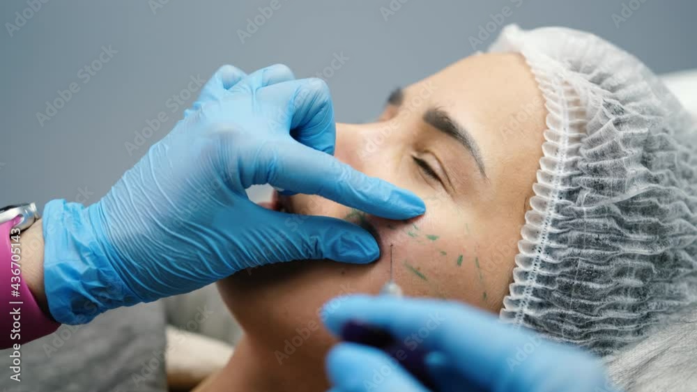 Beautician makes injections on the face of a young woman client in the area around the eyes close-up Beautician makes injections on the face of a young woman client in the area around the eyes close-up