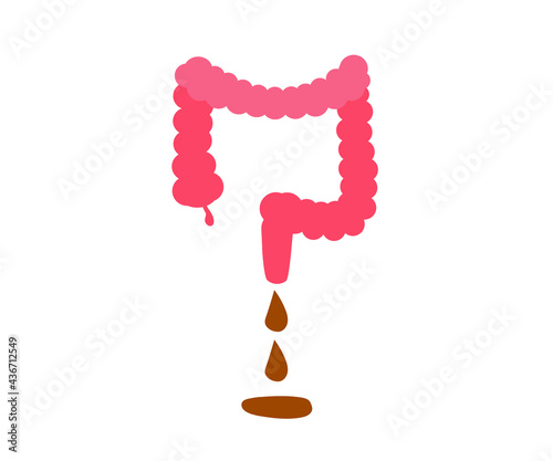 Large intestine on a white background. Diarrhea. Vector illustration.