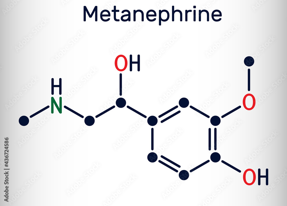 Metanephrine molecule. It is metabolite of epinephrine, adrenaline, biomarker for pheochromocytoma. Skeletal chemical formula Metanephrine molecule. It is metabolite of epinephrine, adrenaline, biomarker for pheochromocytoma. Skeletal chemical formula