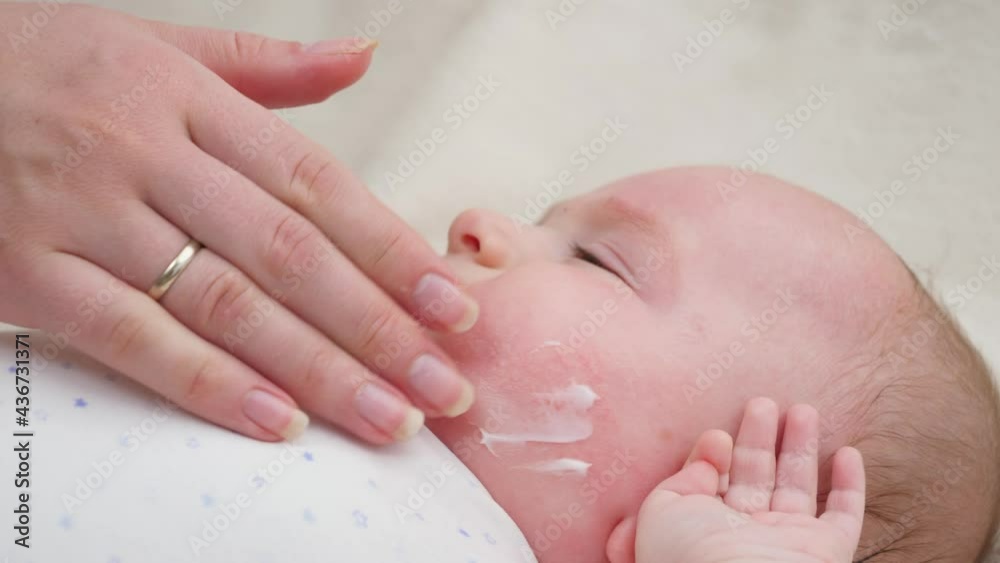 Little baby boy suffering from dermatitis and acne on face skin cured with moistirizing lotion and medical ointment. Concept of newborn baby hygiene, health and skin care. Little baby boy suffering from dermatitis and acne on face skin cured with moistirizing lotion and medical ointment. Concept of newborn baby hygiene, health and skin care.