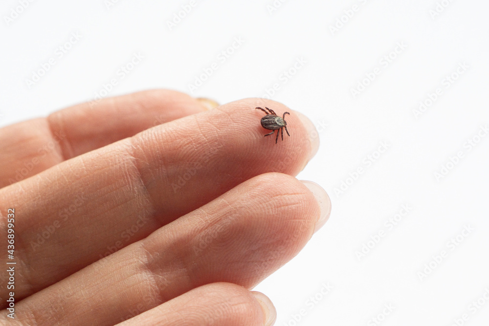 Obraz premium Infected female deer tick on human hand skin. isolated on white background with copy space . Ixodes ricinus. Parasitic mite. Acarus. Dangerous biting insect . Disgusting carrier of infections. Tick