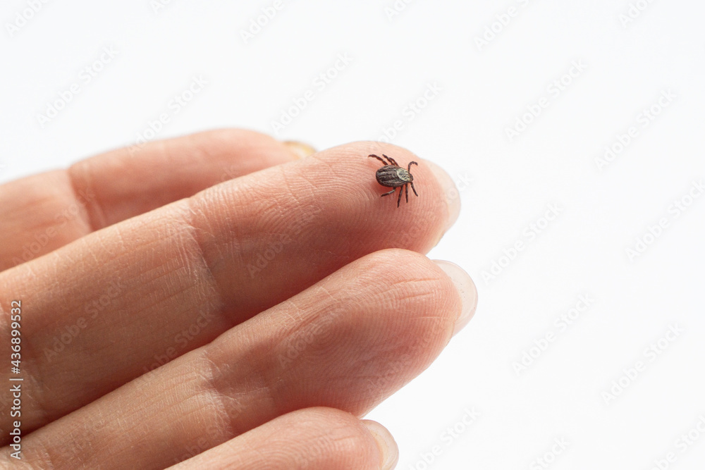 Infected female deer tick on  human hand skin.  isolated on white background with copy space . Ixodes ricinus. Parasitic mite. Acarus. Dangerous biting insect  . Disgusting carrier of infections. Tick