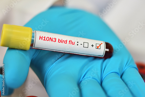 H10N3 bird flu positive, blood sample tube positive with influenza A virus subtype H10N3 photo