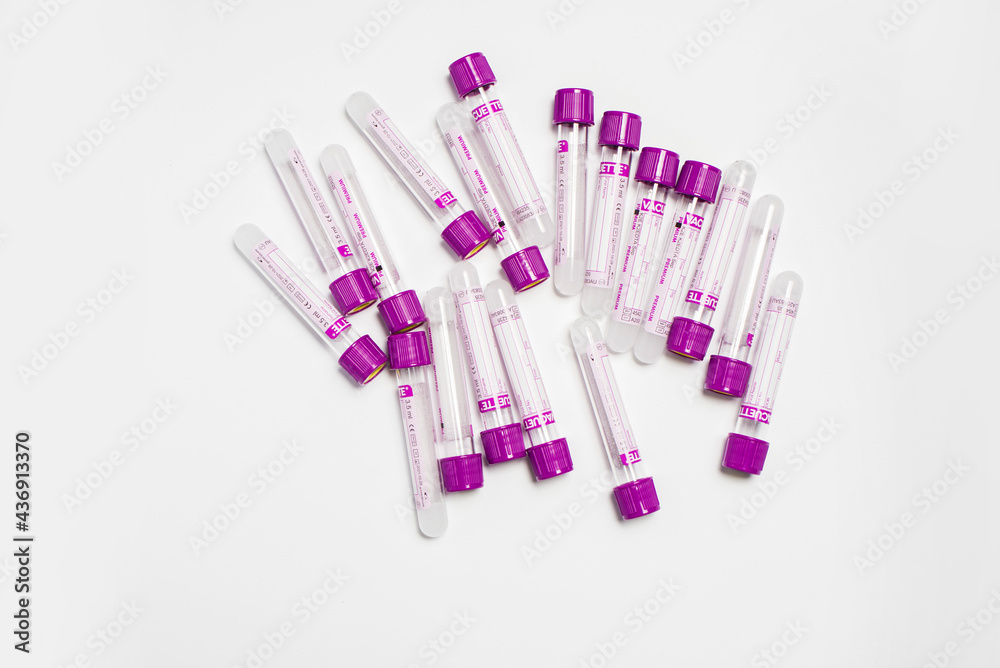 Medecin test tubes for labaroth studies and blood tests. Equipment. Medecin test tubes for labaroth studies and blood tests. Equipment.