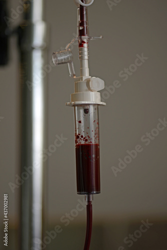blood transfusion in progress