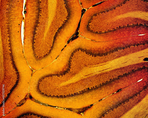 Tableau sur toile Cerebellum. Silver stain