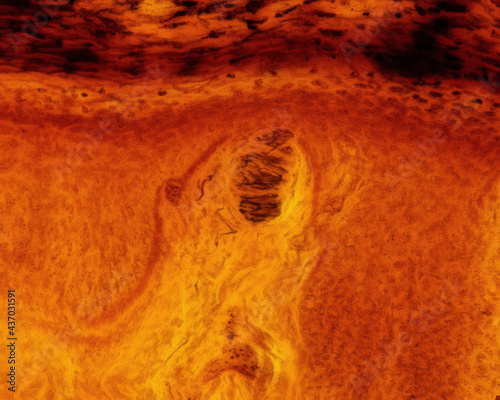 Foto Meissner corpuscle