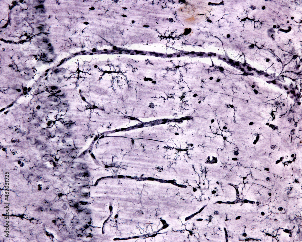 Fototapeta premium Microglia. Rio-Hortega's silver carbonate