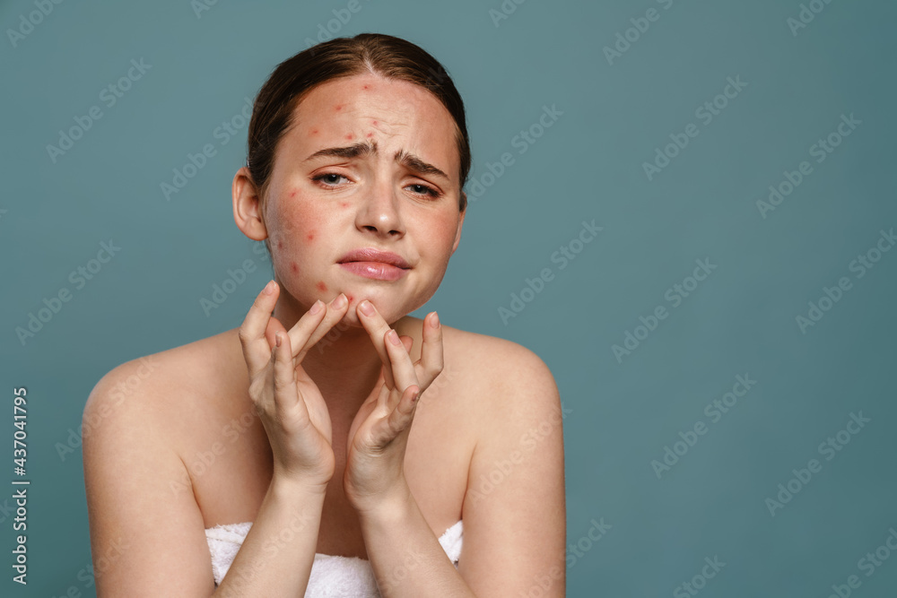 Ταπετσαρία Ginger young woman wearing towel squeezing pimple on her face