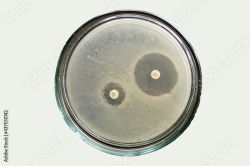 Extended spectrum beta lactamases of E coli bacteria on petri dish photo