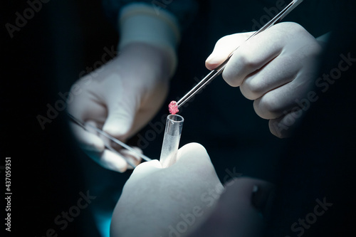 concentrated professional surgical doctor team operating surgery a patient in the operating room at hospital. tumor cancer. surgical biopsy specimens. healthcare and medical concept.