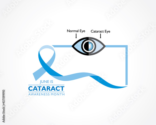 Cataract Awareness Month observed in June, It is a dense, cloudy area that forms in the lens of the eye.