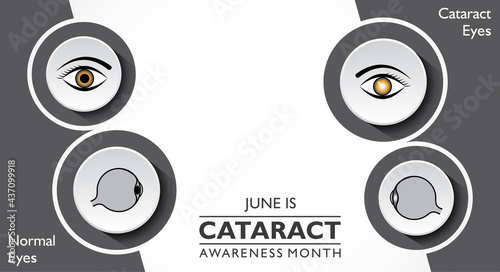 Cataract Awareness Month observed in June, It is a dense, cloudy area that forms in the lens of the eye.