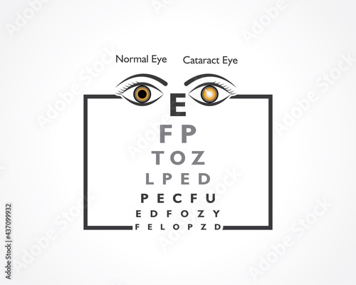 Cataract Awareness Month observed in June, It is a dense, cloudy area that forms in the lens of the eye.