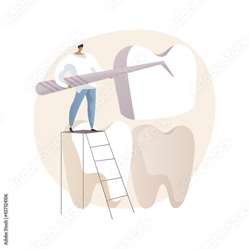 Dental veneers abstract concept vector illustration.