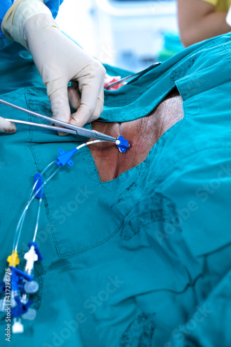 anesthetist setting central venous catheter to patient before open heart surgery