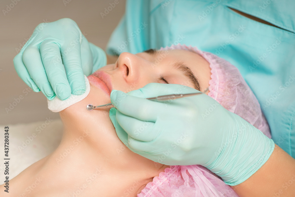 Facial cleansing. Blackhead Removal Tool. Beautician removing blackhead and acne on female chin in a beauty salon Facial cleansing. Blackhead Removal Tool. Beautician removing blackhead and acne on female chin in a beauty salon