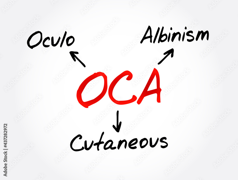 OCA - Oculo Cutaneous Albinism acronym, concept background