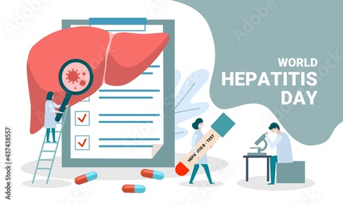 Concept of hepatitis A, B, C, D, cirrhosis, world hepatitis day. Tiny doctors treat the liver. vector illustration.