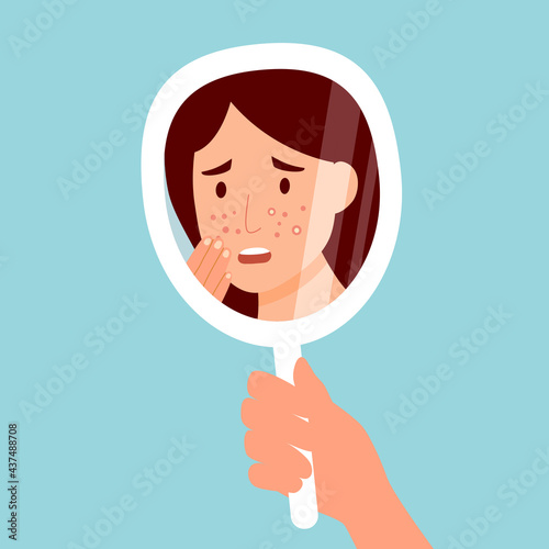 Young woman hand mirror worrying about her acne on face in flat design. Pimple problem on female skin.