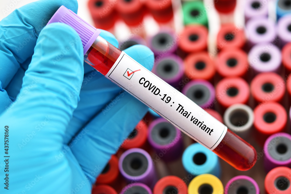 Obraz premium Thai variant of COVID-19, blood sample tube positive with Thai strain of COVID-19 virus