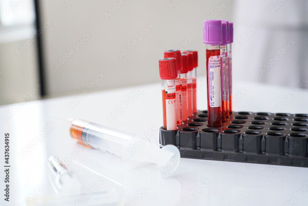 vacutainer and syringe Stock Photo Adobe Stock
