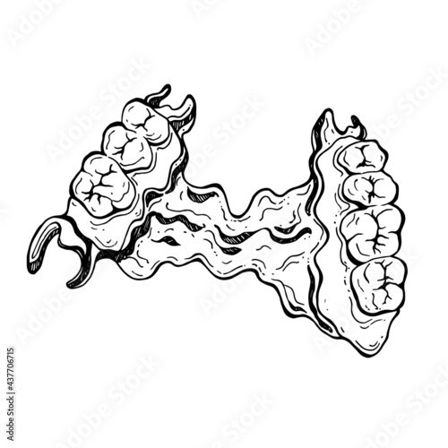 vector doodle illustration of clasp prosthesis. hand drawing of a partial removable denture. dentistry and prosthetics. teeth. orthodontic treatment