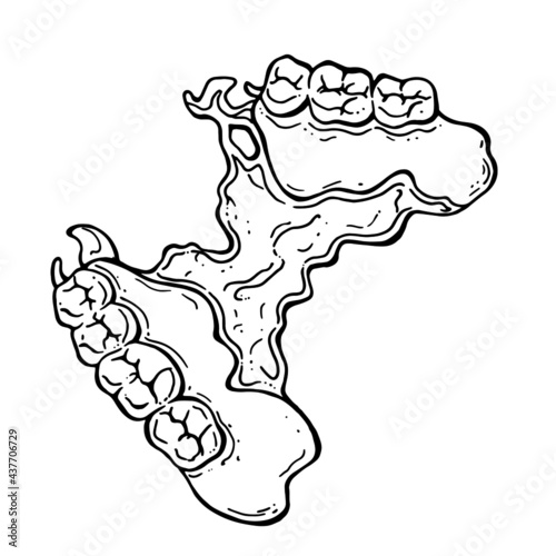 vector doodle illustration of clasp prosthesis. hand drawing of a partial removable denture. dentistry and prosthetics. teeth. orthodontic treatment