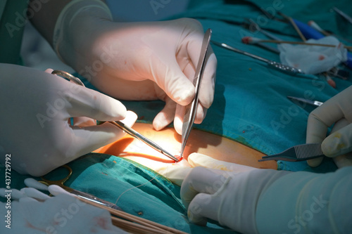 A team of doctors working together in the operating room