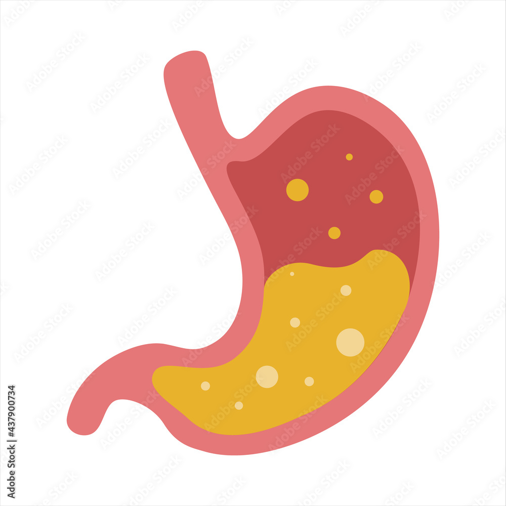 Heartburn and acidity of the stomach. Vector flat cartoon illustration on white background Heartburn and acidity of the stomach. Vector flat cartoon illustration on white background