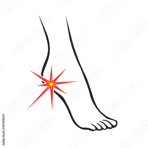Leg with heel pain. Orthopedic disease plantar fasciitis. Vector isolated outline illustration
