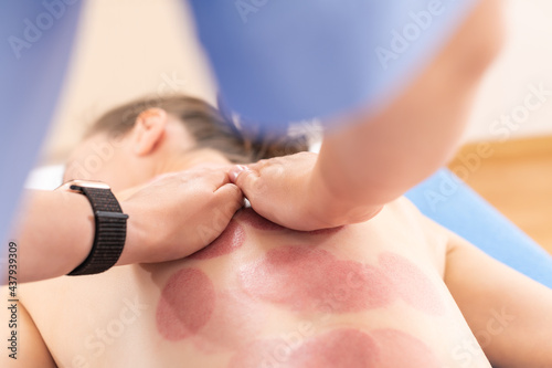 Therapist massaging female patient after cupping therapy. Treatment used in Traditional Chinese Medicine for pain relief and other health benefits.