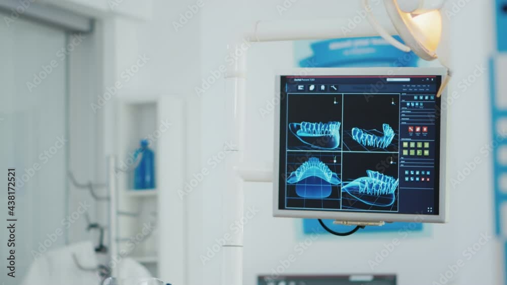 Close-up of teeth radiography on display in modern stomatology orthodontic hospital bright office. Empty orthodontist medical hospital office equipped with professional tooth instruments Close-up of teeth radiography on display in modern stomatology orthodontic hospital bright office. Empty orthodontist medical hospital office equipped with professional tooth instruments
