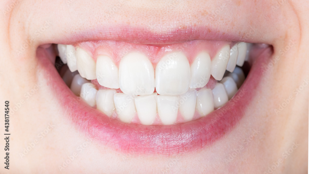 Concept of healthy smile with medically treated teeth. White smile with healthy teeth. Smile after tooth whitening. Concept of healthy smile with medically treated teeth. White smile with healthy teeth. Smile after tooth whitening.