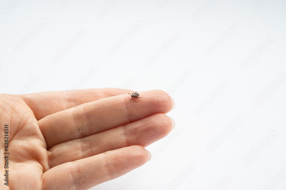 Infected female deer tick on human hand skin. Ixodes ricinus. Parasitic mite. Acarus. Dangerous biting insect on background of epidermis detail . Copy space . Disgusting carrier of infections. Infected female deer tick on human hand skin. Ixodes ricinus. Parasitic mite. Acarus. Dangerous biting insect on background of epidermis detail . Copy space . Disgusting carrier of infections.