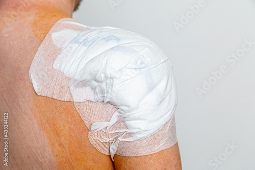 Verband nach einer Schulteroperation, nach einem Unfall