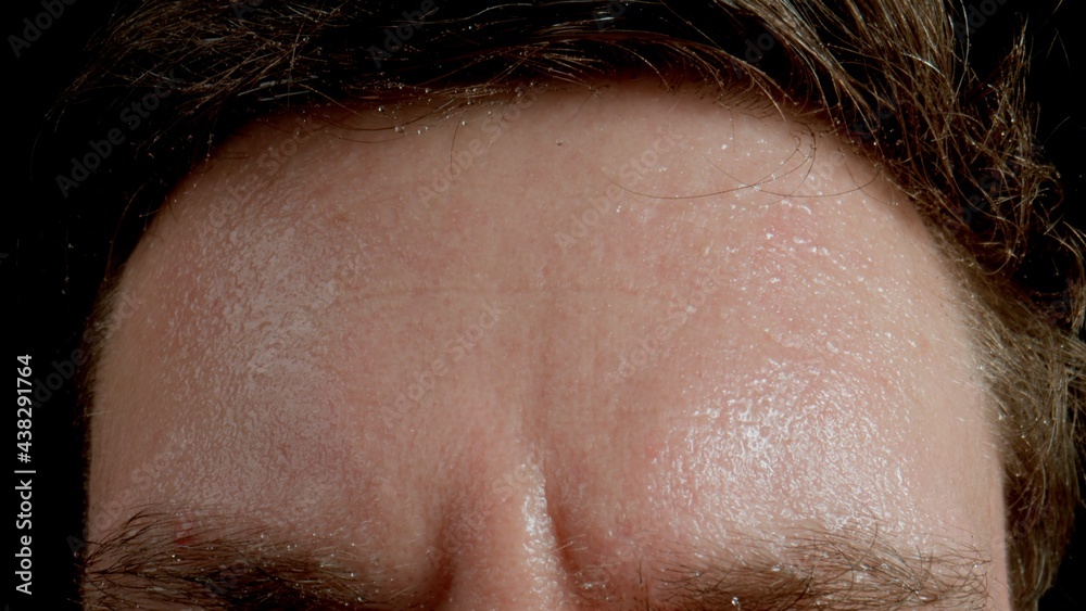 Forehead of very sweating adult young man Forehead of very sweating adult young man