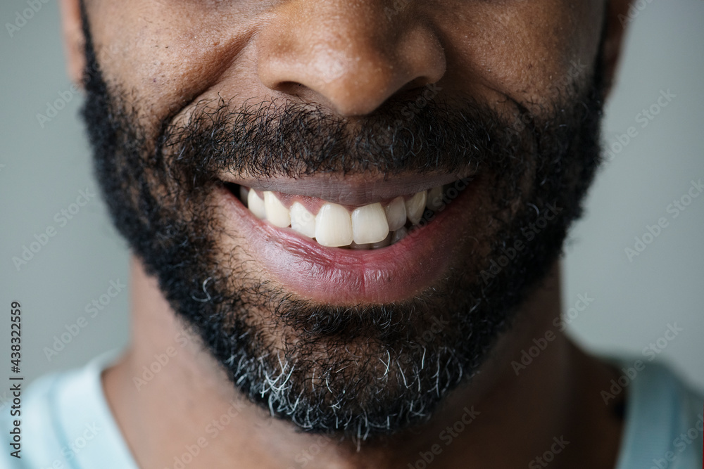Obraz premium Closeup of smiling teeth of a black man