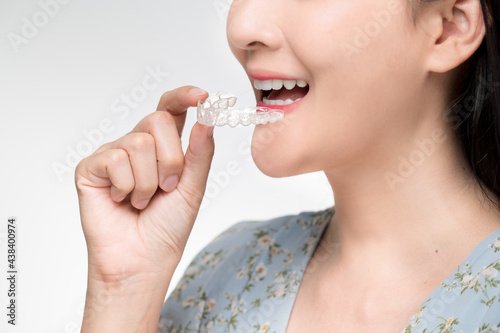 Asian woman wearing orthodontic silicone trainer. Mobile orthodontic appliance for dental correction. tooth whitening systems.