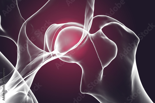 Canine dysplasia dog bones