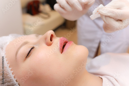 The cosmetologist rubs the girl's lips with oil for care after the lip augmentation procedure with hyaluronic acid