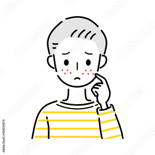 男性　ニキビ　吹き出物