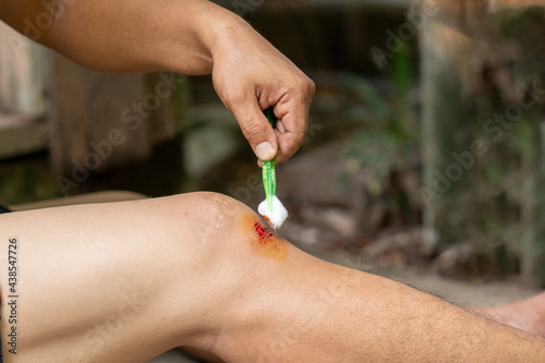 Person with fresh bleeding wounds on the knees The damage is treated with an adhesive bandage, to prevent the blood from flowing. closeup