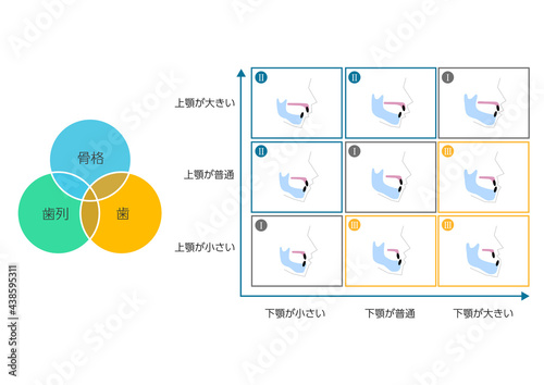 矯正歯科・歯の噛み合わせ表