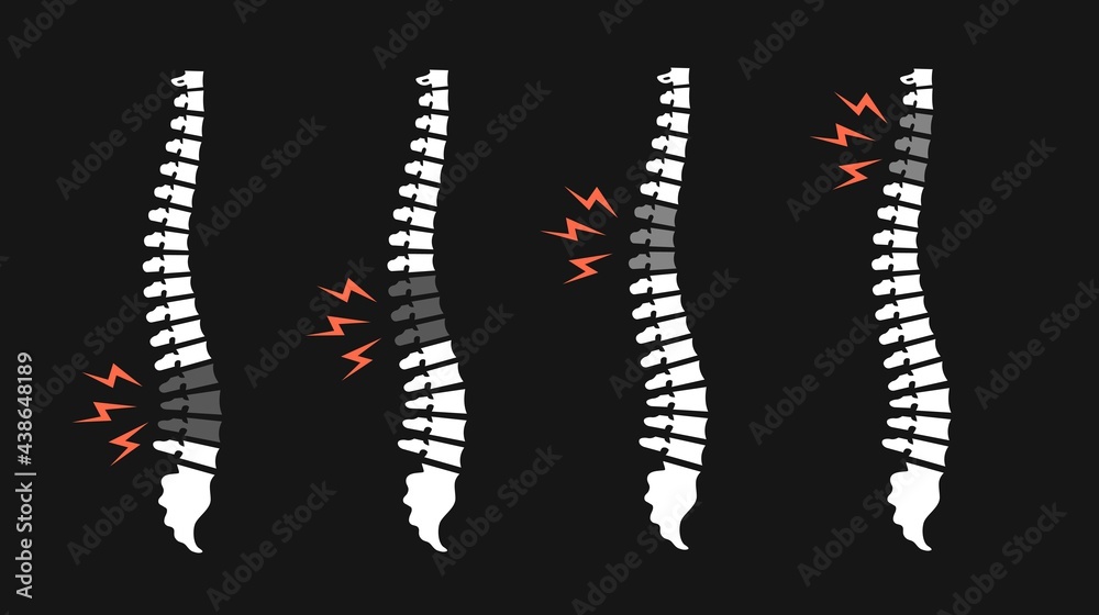 Back pain vector icon illustration isolated on black. Backache spines set. Damaged Disks Back pain vector icon illustration isolated on black. Backache spines set. Damaged Disks