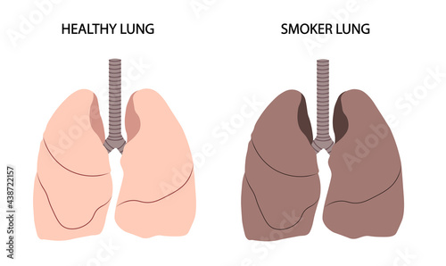 Healthy versus smoker lung illustration. 