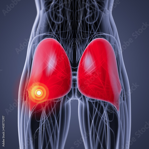 medical  illustration of the gluteus maximus photo